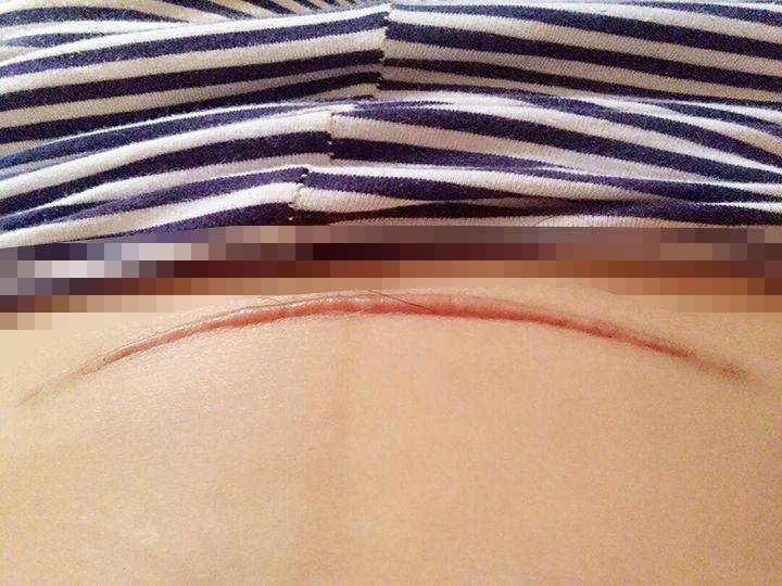 生育|45岁女强人,生3胎后急速衰老:生育,带给女人的究竟是什么?