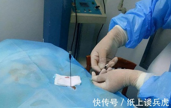 生存期|“不要抢救我”!65岁老人肝癌晚期拒绝手术化疗,带着尊严离去