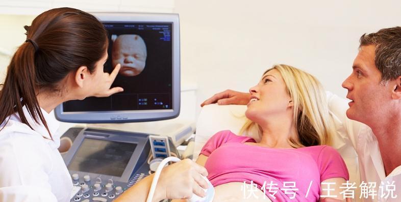 脐带|一听到脐带绕颈四个字,孕妈们就如临大敌,其实起因十分正常