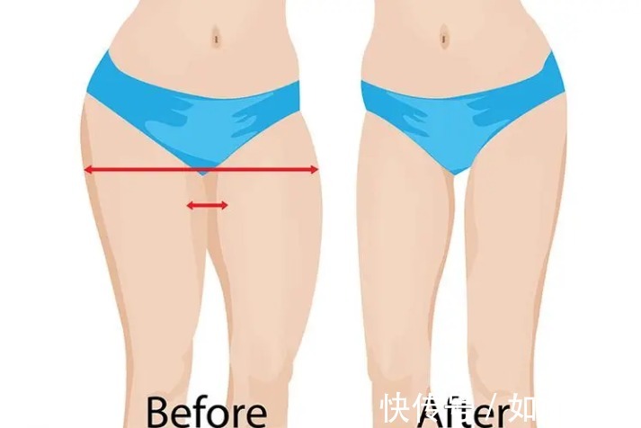 抽脂 吸脂手术疼痛度如何?术后怎样才能快速恢复呢?