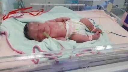 产妇|准妈妈不惜一切的去保护孩子，孩子出生后，产妇却当场被吓晕