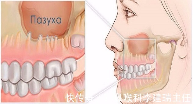 耳鼻喉科|五颜六色的鼻涕，暗藏鼻炎的健康玄机 可惜很少有人知道！