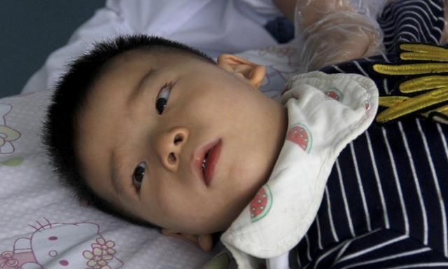 儿子|男童出生因缺氧致脑出血,8个月大被确诊脑瘫,每天只睡2小时