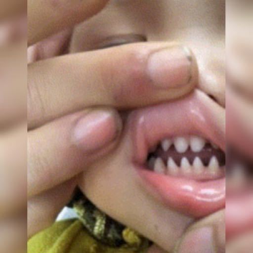 牙齿|萌娃张口的一瞬间令人诧异,牙齿像“鲨鱼牙”,网友父母惹的祸