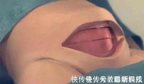 孕妈|剖腹产只是“挨一刀”就完事看完手术全过程,忍不住心疼女人
