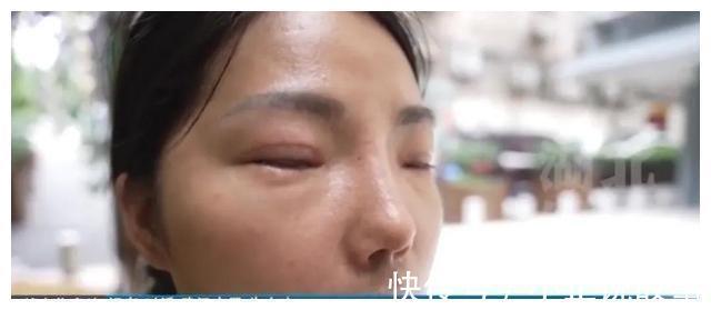 医生 女子整容失败,说好的明星同款鼻子,术后直言笑都很困难!