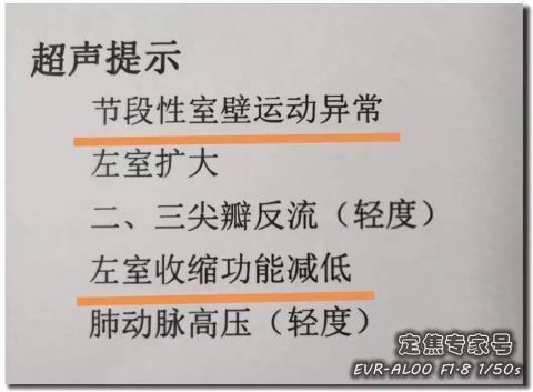 心肌|从“上火”到心肌死亡仅5天！牢记16字，必要时能救命！