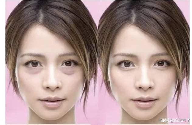 黑眼圈|建议女人,涂眼霜时要注意这3点“误区”,否则眼霜再贵也没效果