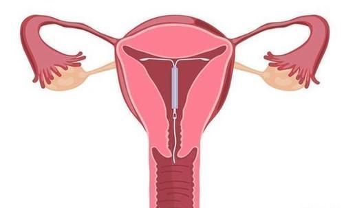 内分泌失调|每次来月经,都持续十几天,是怎么回事?经期几天属于正常现象?