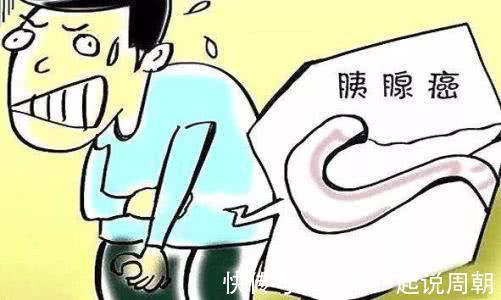 癥狀|4種比較狡猾的癌癥，早期幾乎沒癥狀，別等晚期才后知后覺