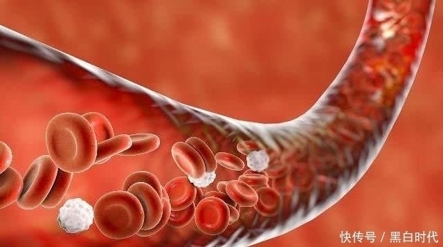 血管|天然的“降脂食物”,每天吃一吃,告别高血脂,让血管一通到底