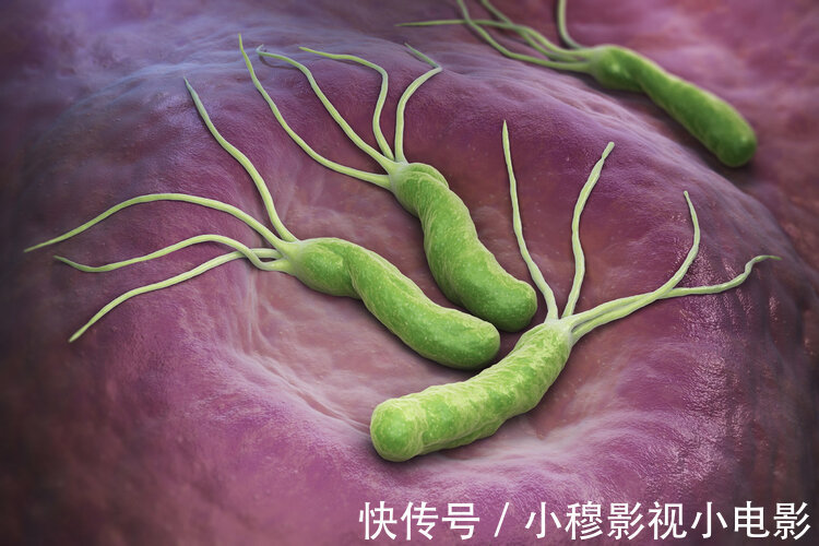 夫妻癌|癌症不传染？医生：别高兴得太早，这3种致癌病毒会“人传人”