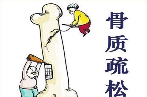 大骨汤|别拿骨质疏松不当回事,这些误区要了解,别等着骨折的时候再着急