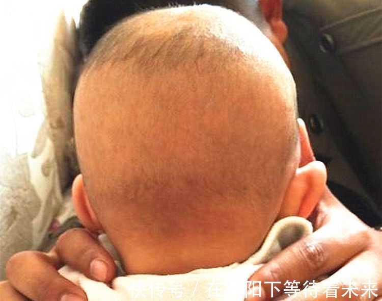 孩子|孙子满月被奶奶剃成光头,头发再也没长出来,医生怒斥家长无知