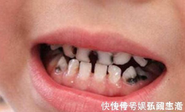 洁白|想要宝宝牙齿洁白,这3点家长要做好,帮娃告别“小黑牙”