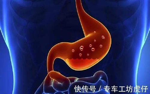 胃炎|反流性胃炎不能吃什么?这几种食物不要贪吃,小心反流加重!