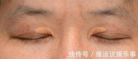 食疗|脸上有2个症状,说明血脂很高了,调理高血脂只要2招