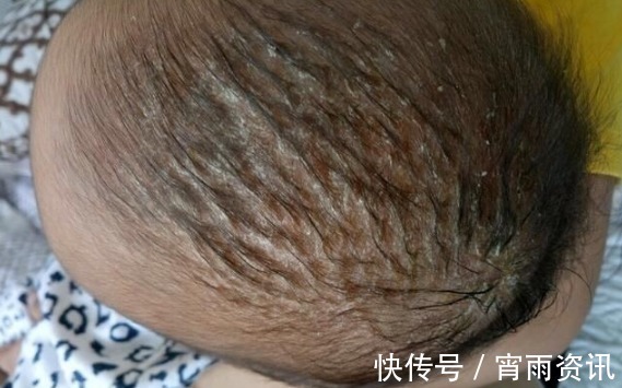 鼻屎|新生儿出生后,不能对宝宝做的9件事,新手爸妈早了解别坑娃