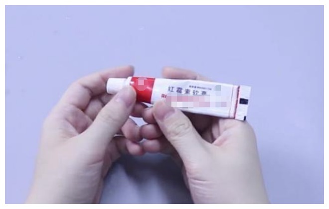 黄褐斑|一块钱的红霉素软膏,怎么成了“淡斑专家”听听医生怎么说