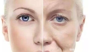 慢性肝炎|身体忽然出现两种痣,可能是你肝脏有问题,要及时排毒素了