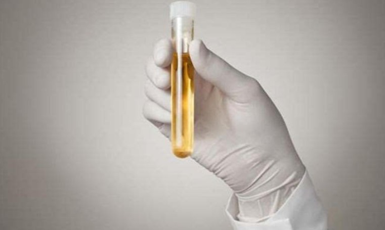 泡沫|男人晨起“第一次小便”,若无3个表现,偷乐吧,肾脏很强壮