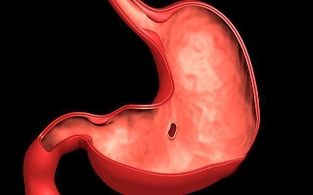 胃黏膜|胃不舒服的人,记住2吃2喝,杀菌养胃,修复黏膜,胃一天天更好