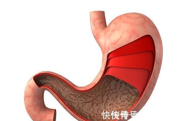 碳水化合物|常吃糯米究竟是养胃还是伤胃,如何吃更健康?一起了解下吧