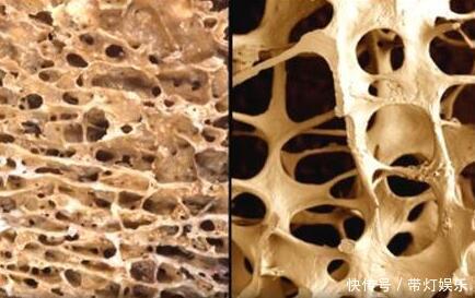  养生|87岁老中医养生秘诀骨质疏松多吃3物，常喝1白，骨密度蹭蹭涨