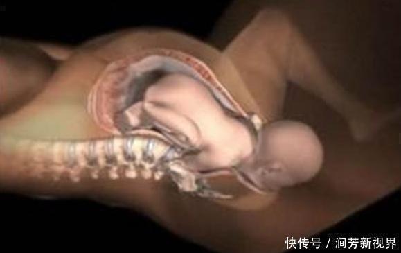 顺产|顺产分娩时,宝宝咋从产道中爬出来的带你看清全过程,真心不易