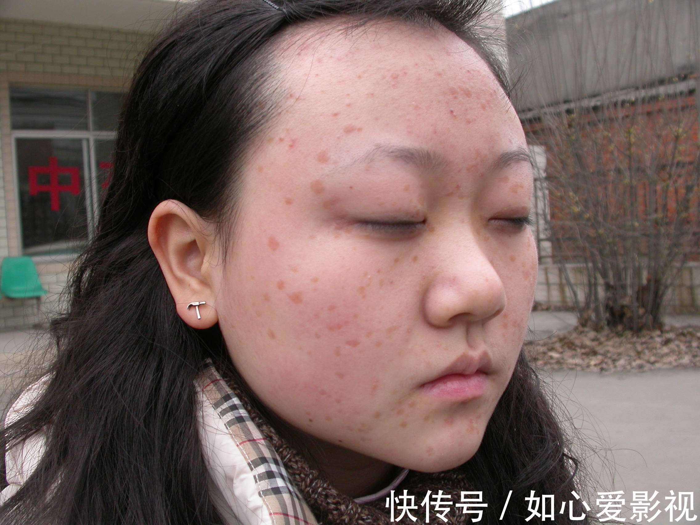 患处|治疗皮肤病的经典秘方！看看有您需要的吗？太难找，好好收藏！