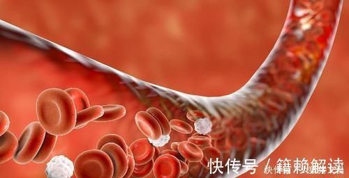 疏通|血管“堵塞”不用慌,多吃5种食物,疏通血管,和血栓说拜拜