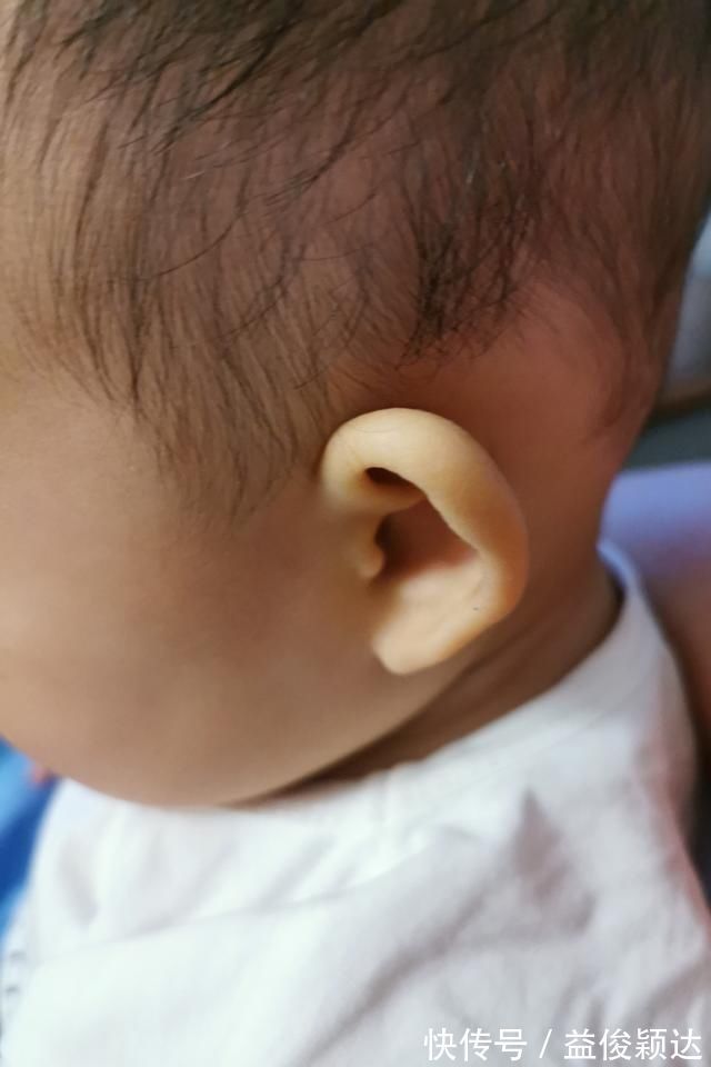 耳廓|娃的睡姿不当会影响耳朵发育,导致“招风耳”3个问题一次说清