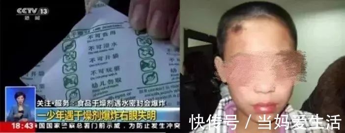 包装袋|别让孩子拿它当“玩具”,小心眼球“被融”,家里有的抓紧仍