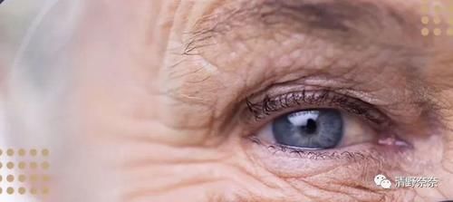 这些变化代表你老了!韩国女生最怕的5个老化现象