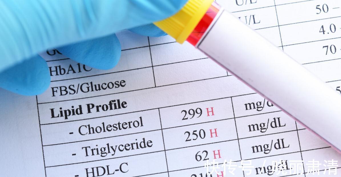 血脂偏高|医生:别搞错了,这项血脂偏高不需要治疗,而且还要想办法提高它