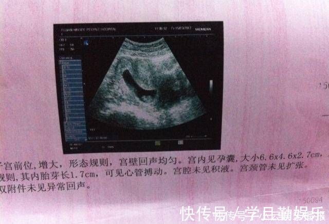 胎囊|怀孕后,如果怀孕的妈妈有这三场表演,也许她是肚子里的小公主,提前恭喜