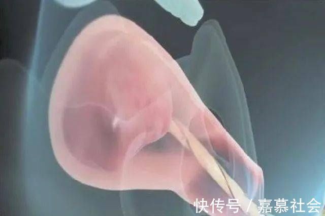 产妇|产道那么小胎儿到底咋出来的?看完这组图泪目了,女人太不容易了