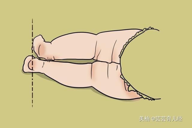 家长最容易忽视的部位，却透露着宝宝的重要健康信号，别不在意了