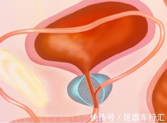 南瓜素|21岁大学生“857”成瘾一周5次,患上前列腺炎,还被割掉部分腺体