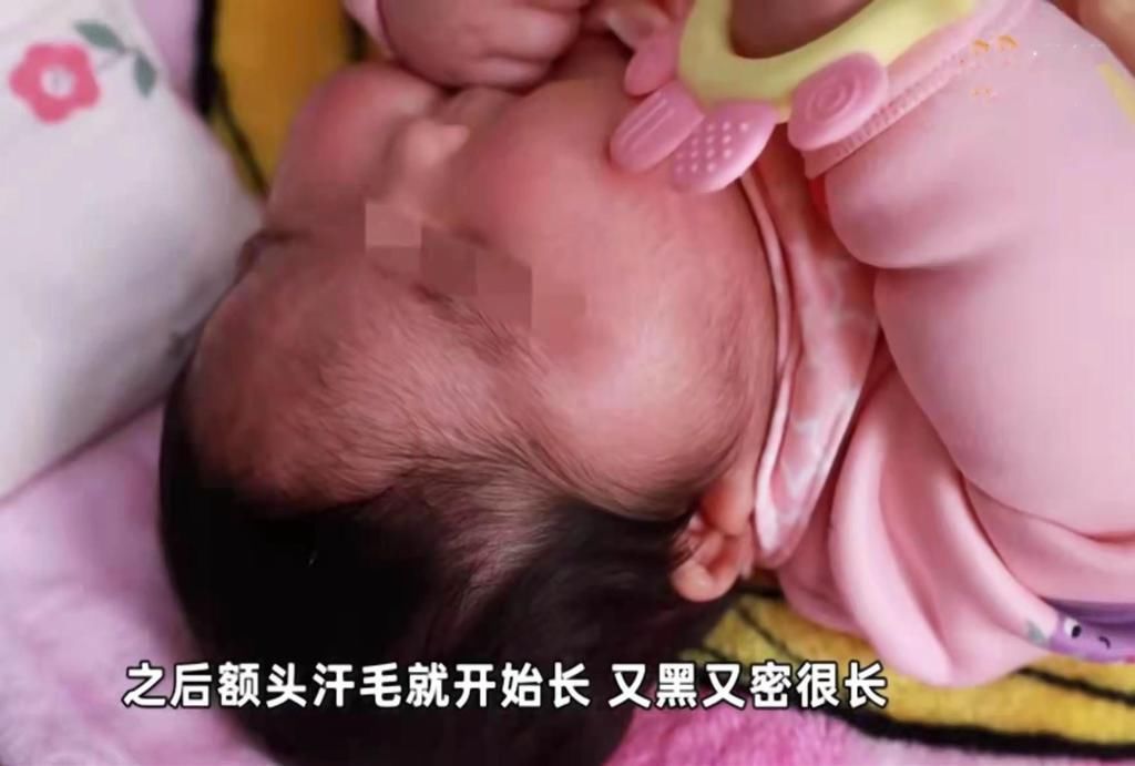 大头|新生儿两个月变“大头宝宝”,背后“凶手”竟是婴儿霜