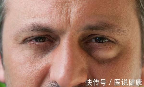 肝功能|肝不好，脸先知！医生：脸上若有这3个特征，或是肝脏癌变的信号