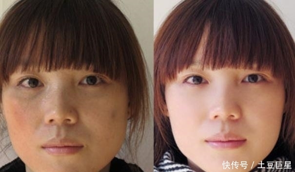 土豆加上常见的“它”,一周使用三四次,不出一个月美白淡化色斑