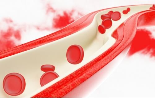 血脂|血脂高的人,头部容易有3种表现,或是脑梗的预兆,趁早进行检查