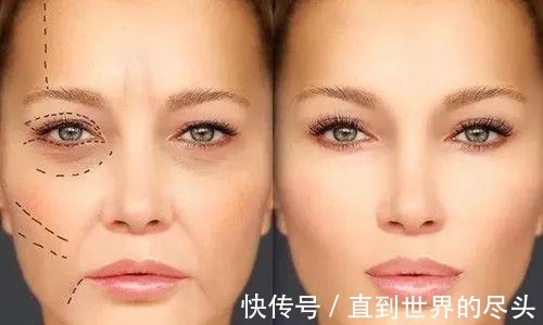 医美 法令纹是怎么来的法令纹填充如何避免僵硬_芯动医美课堂!