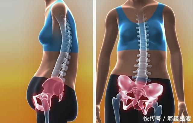 宝妈|头胎选择剖腹产，二胎可以顺产吗？若孕妈是这三种情况，就别想了