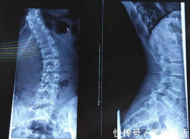 区别|睡枕头的孩子和不睡枕头的孩子,长大有什么区别差距可不止一点