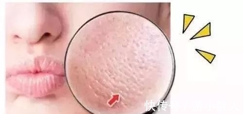 毛孔 小心!以下5个护肤坏习惯,能让你的毛孔越来越大……