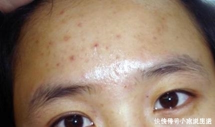 皮肤状态差,堪称60岁的老大妈,平时做好3步,肌肤光亮迷人