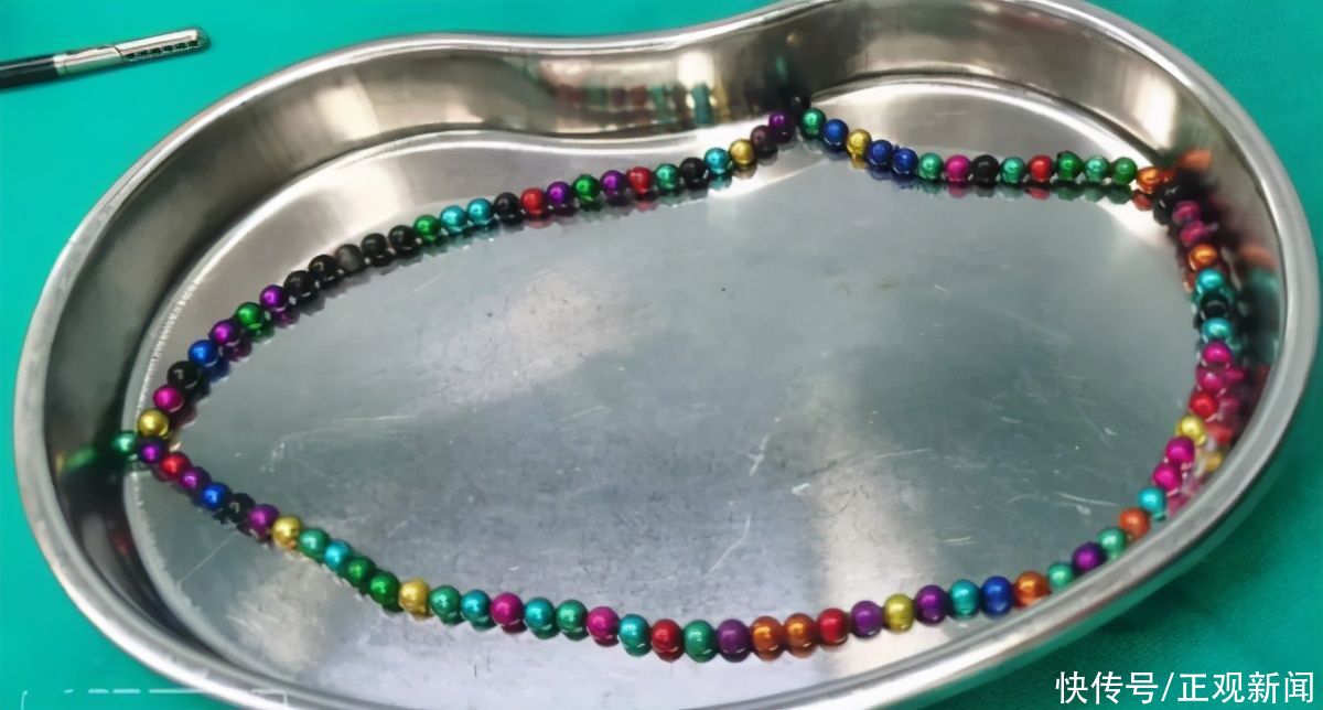 异物|危险！洛阳4岁女童误吞105颗磁力珠致肠道6处穿孔