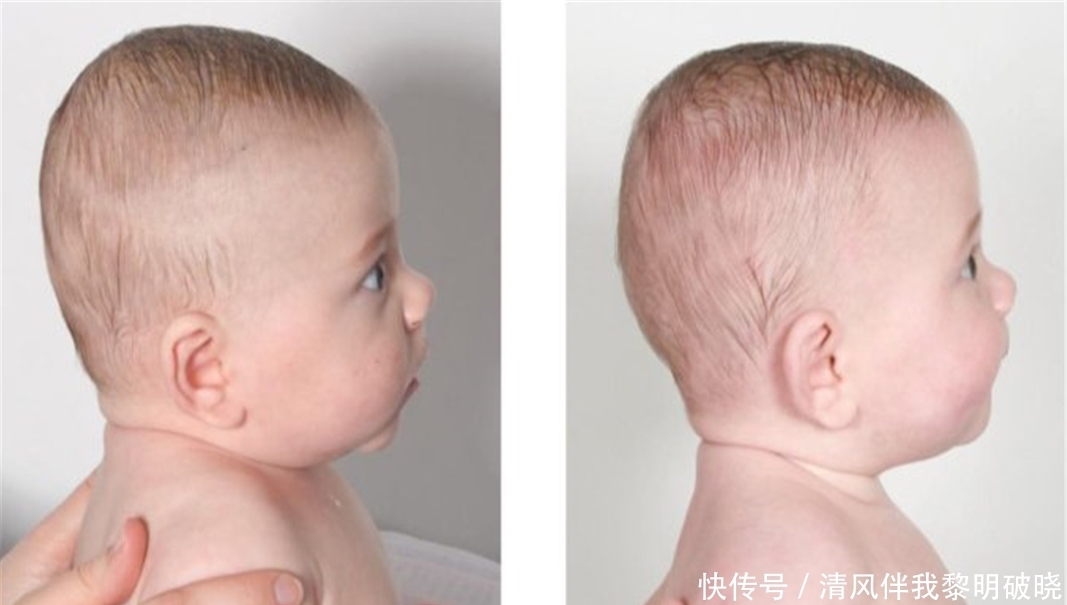 基因|这种“头型”的宝宝，自带“高个”基因，未来长高潜力大